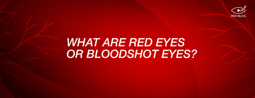 Red Eyes / Bloodshot Eyes - Causes & Treatment