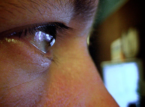 Common environmental causes of red eyes like dust and air pollution