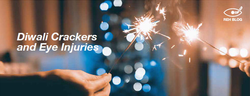 Diwali Crackers and Eye Injuries