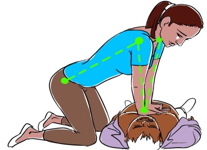 Correct hand placement for COLS chest compressions